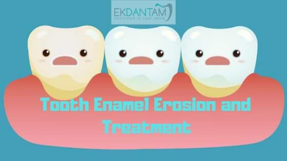 Tooth Enamel Erosion and Treatment (1)